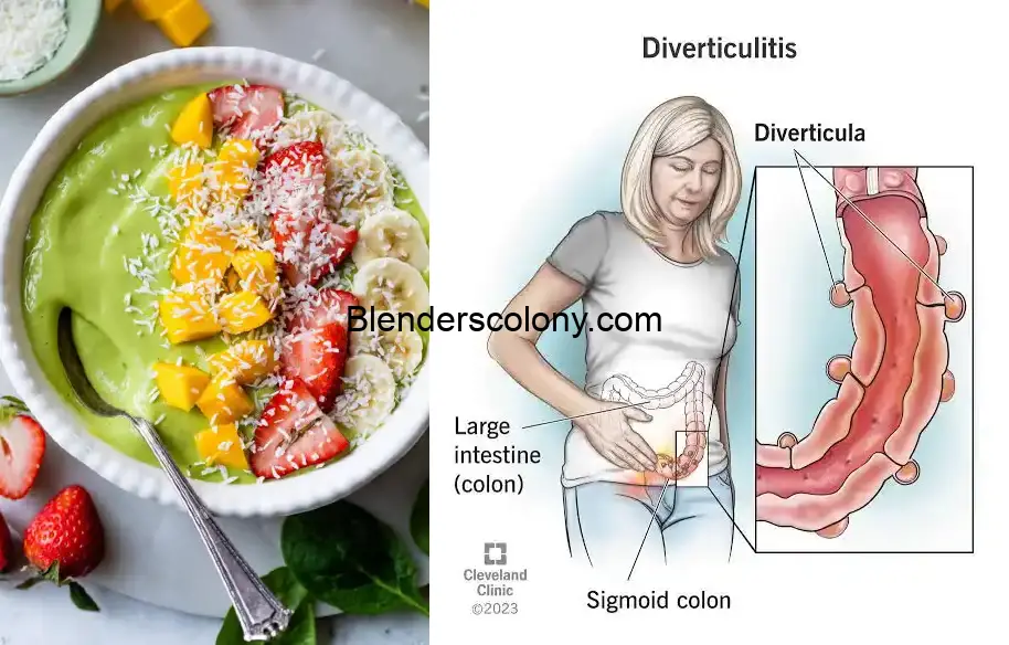 are smoothies good for diverticulitis